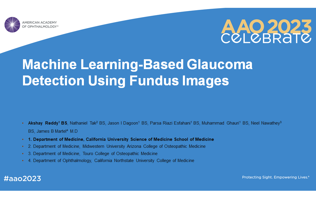 Machine Learning-Based Glaucoma Detection Using Fundus Images (AAO 2023)