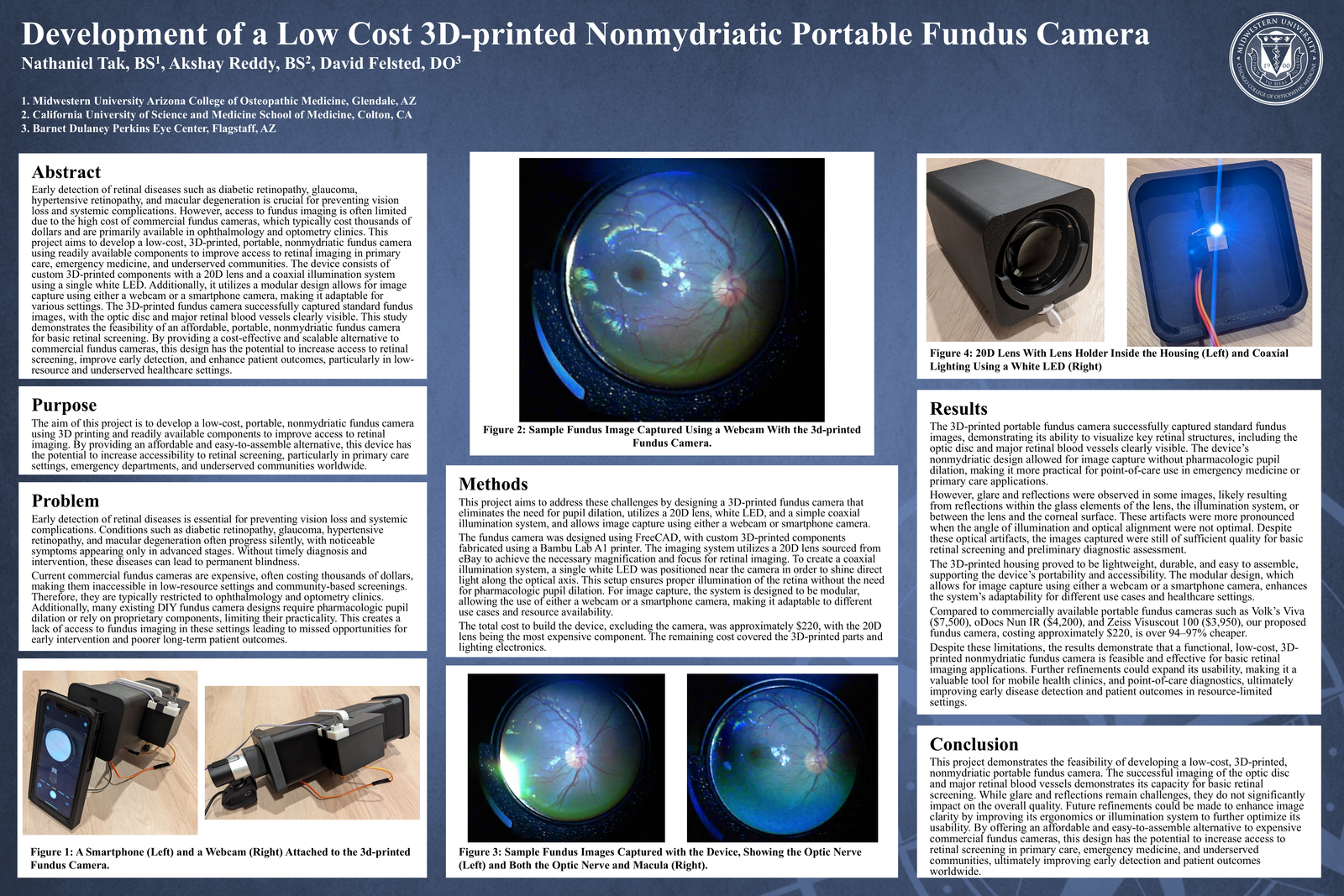 Development of a Low Cost 3D-printed Nonmydriatic Portable Fundus Camera