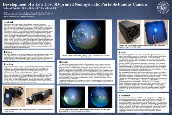 Development of a Low Cost 3D-printed Nonmydriatic Portable Fundus Camera