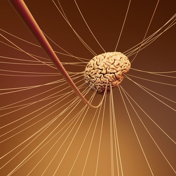 The Acute Stroke Workup: Time is Brain, But What Comes Next?